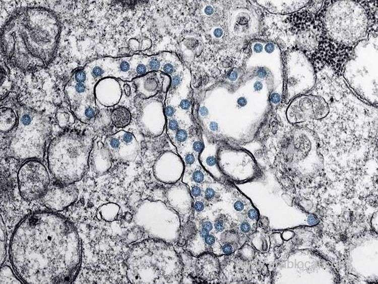 health-ministry-declared-12-confirmed-cases-of-coronavirus-in-qatar_qatar