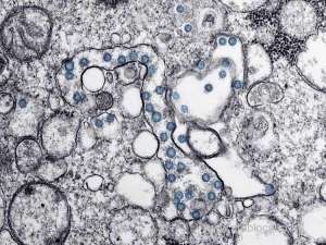 health-ministry-declared-12-confirmed-cases-of-coronavirus-in-qatarqatar