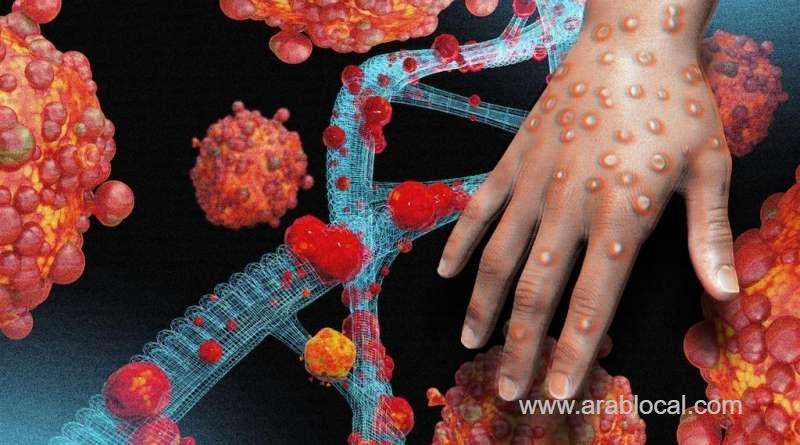 qatar-ministry-confirms-no-monkeypox-virus-cases-in-the-country_qatar