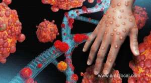 qatar-ministry-confirms-no-monkeypox-virus-cases-in-the-countryqatar